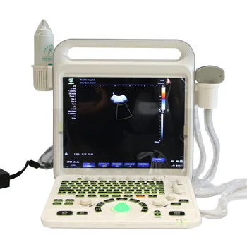 MI-A027B 15 inch ecran medicale instrumente cu ultrasunete,portabil, ecograf doppler color