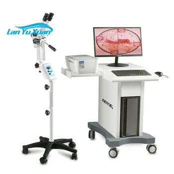 Portabile medicale Video Colposcop Electronic Portabil mini HD digital optic colposcop Pentru Ginecologie colposcopio